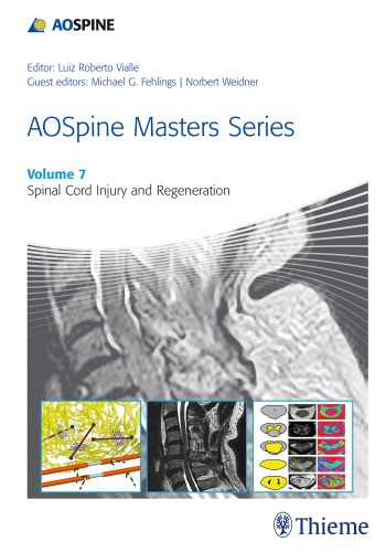﻿AO spine Master Series