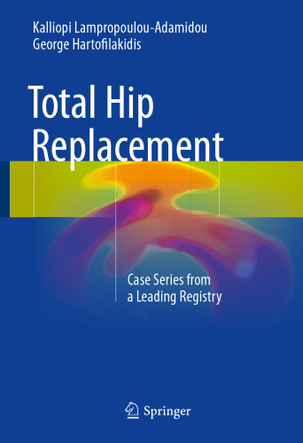﻿Total Hip Replacement: سری پرونده های ثبت شده پیشرو