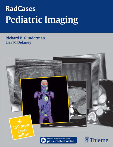 ﻿تصویربرداری کودکان