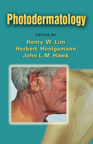 ﻿فتودرماتولوژی