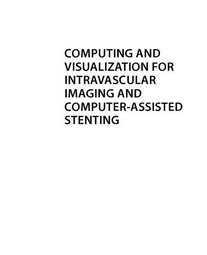 ﻿محاسبات و تجسم برای تصویربرداری داخل عروقی و استنت گذاری به کمک رایانه