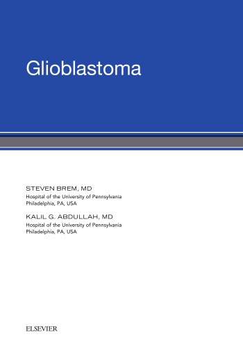 گلیوبلاستوما