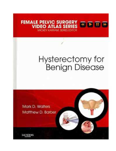 ﻿هیسترکتومی برای بیماریهای خوش خیم