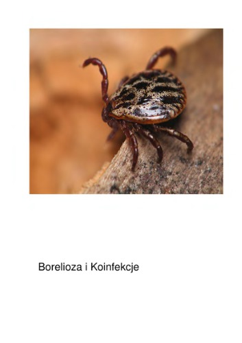 ﻿بیماری لایم و عفونت های همزمان