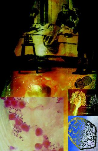 اطلس پزشکی عفونی