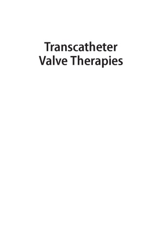 روشهای درمانی دریچه Transcatheter
