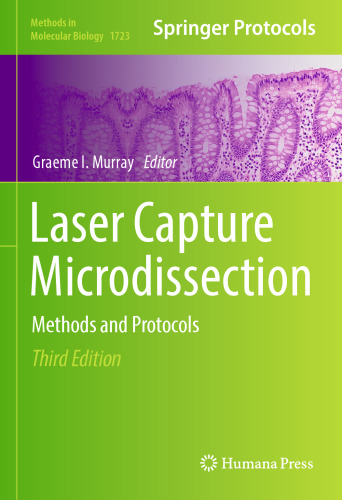 Microdissection لیزر ضبط: روش ها و پروتکل ها