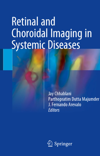تصویربرداری شبکیه و کوروئیدی در بیماریهای سیستمیک