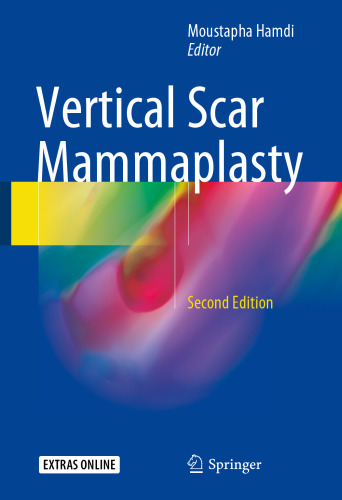 ﻿ماموپلاستی اسکار عمودی