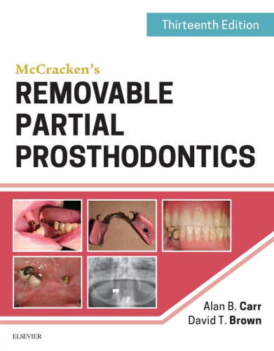 Prosthodontics جزئی قابل جابجایی McCracken، 13e