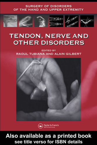 ﻿تاندون، اعصاب و سایر اختلالات