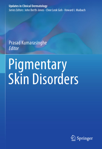 ﻿اختلالات رنگدانه ای پوست