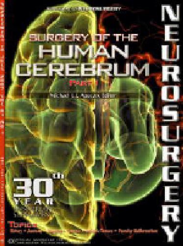 جراحی مغز انسان