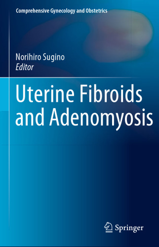 ﻿فیبروم رحم و آدنومیوز