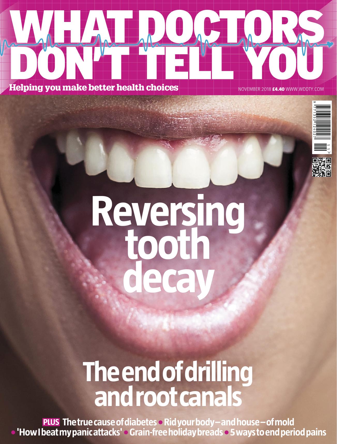 ﻿آنچه پزشکان به شما نمی گویند - معکوس کردن پوسیدگی دندان، پایان سوراخ کردن و کانال ریشه