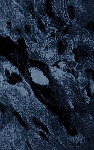 پروتکل های تحقیق متاستاز. تجزیه و تحلیل سلول ها و بافت ها