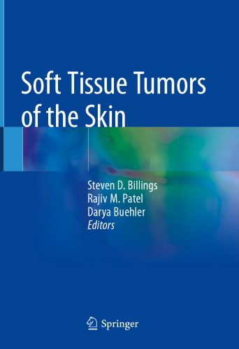 ﻿تومورهای بافت نرم پوست