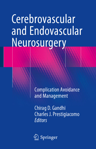 ﻿جراحی مغز و اعصاب عروقی و اندوواسکولار: پیشگیری و مدیریت عوارض