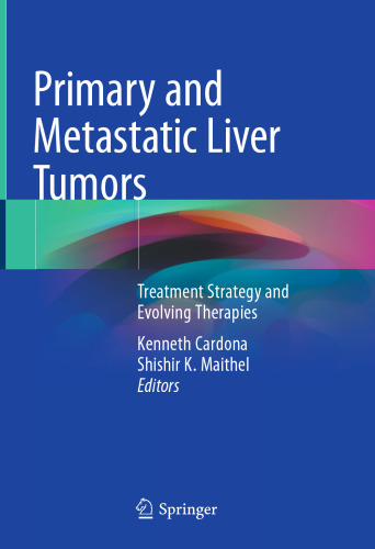 ﻿تومورهای اولیه و متاستاتیک کبد: استراتژی درمان و درمان های در حال تکامل