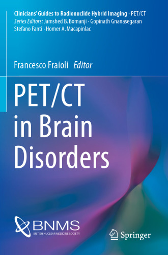 ﻿PET/CT در اختلالات مغزی