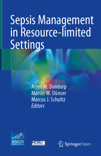 ﻿مدیریت سپسیس در تنظیمات محدود به منابع