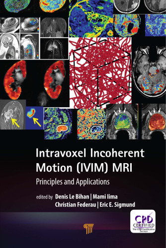 ﻿حرکات ناهماهنگ داخل intravoxel (IVIM) MRI: اصول و برنامه ها