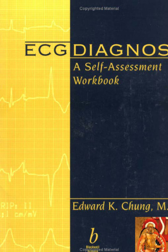 ﻿تشخیص ECG: کتاب کار خود ارزیابی