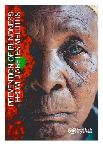 ﻿پیشگیری از نابینایی ناشی از دیابت ملیتوس: گزارش مشاوره WHO