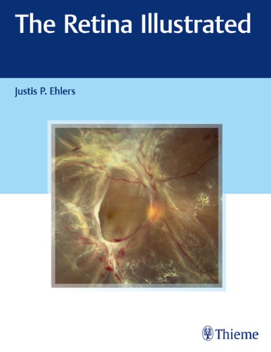 ﻿شبکیه چشم مصور