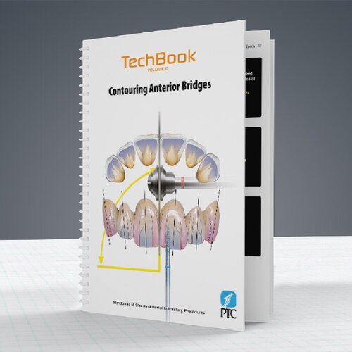 ﻿کانتورینگ پل های قدامی