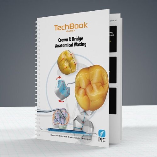 ﻿اپیلاسیون تشریحی تاج و پل