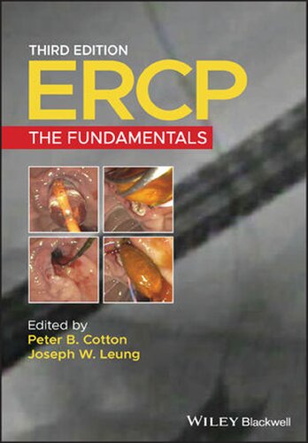 ﻿Ercp: اصول