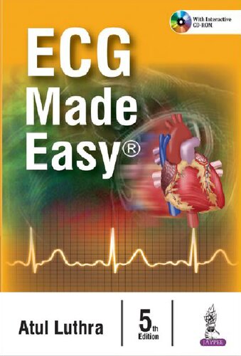 ﻿ECG آسان شد
