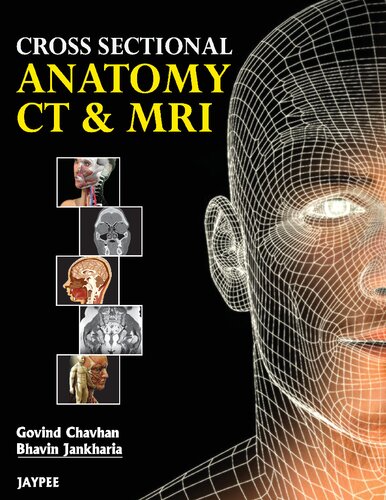 ﻿CT و MRI آناتومی مقطعی