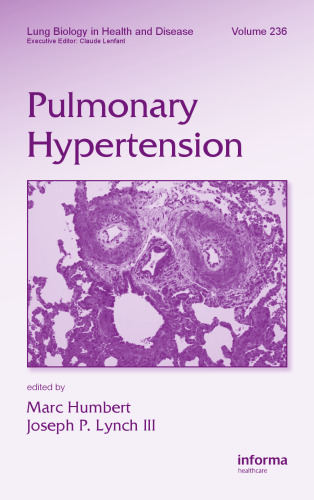 ﻿فشار خون ریوی