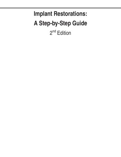 ﻿ترمیم ایمپلنت: راهنمای گام به گام