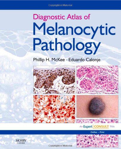 ﻿اطلس تشخیصی آسیب شناسی ملانوسیتی