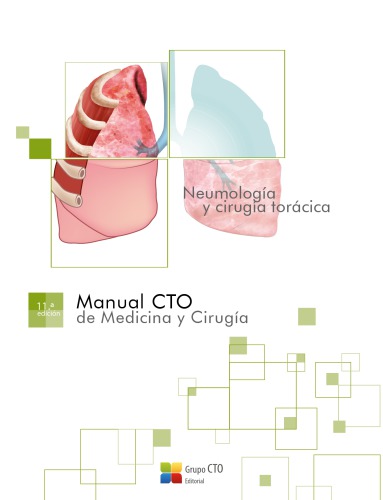 ﻿راهنمای CTO - پنومولوژی و جراحی قفسه سینه