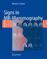 ﻿علائم در MR-Mammography