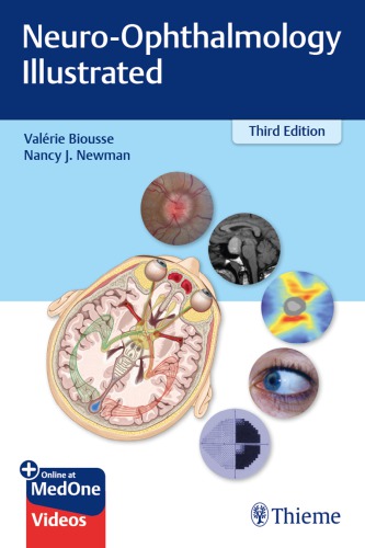 ﻿Neur-Ophthalmology Illustrated