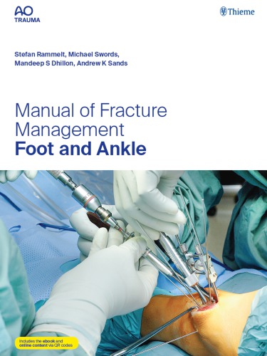 ﻿راهنمای مدیریت شکستگی - پا و مچ پا