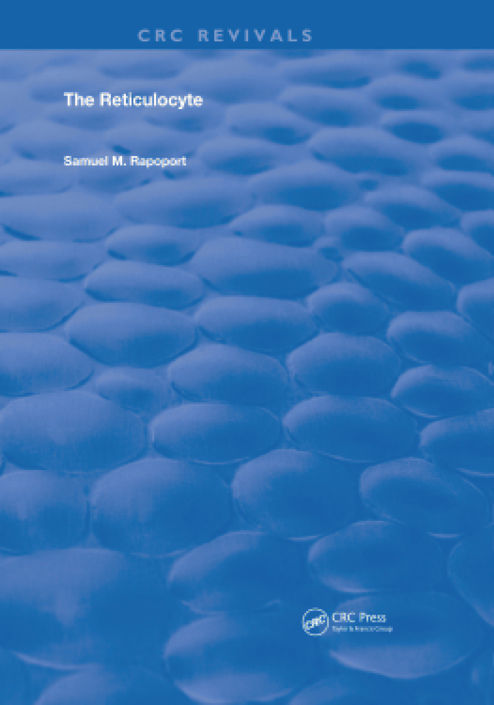 ﻿رتیکولوسیت