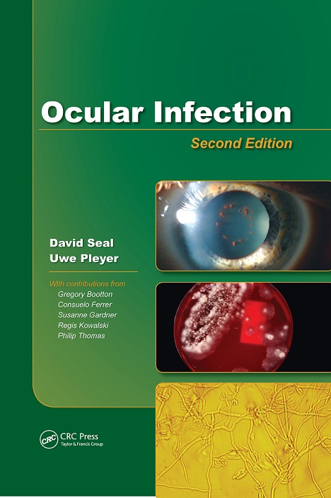 ﻿عفونت چشمی: بررسی و درمان در عمل