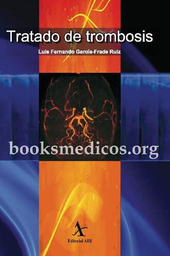 ﻿درمان ترومبوز