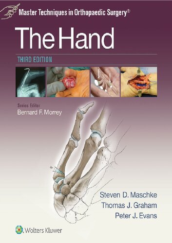﻿The Hand 3rd Edition