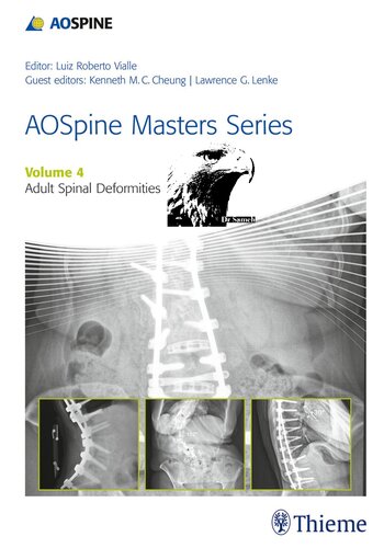 ﻿Aospine Masters Series, Volume 4: Adult Spinal Deformities