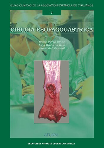 ﻿جراحی مری معده