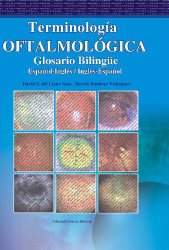 ﻿اصطلاحات چشم پزشکی. واژه نامه دو زبانه