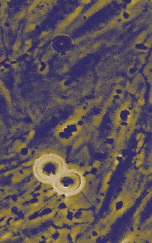 سیتوژنتیک سرطان. روش ها و پروتکل ها