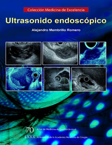 ﻿سونوگرافی آندوسکوپی